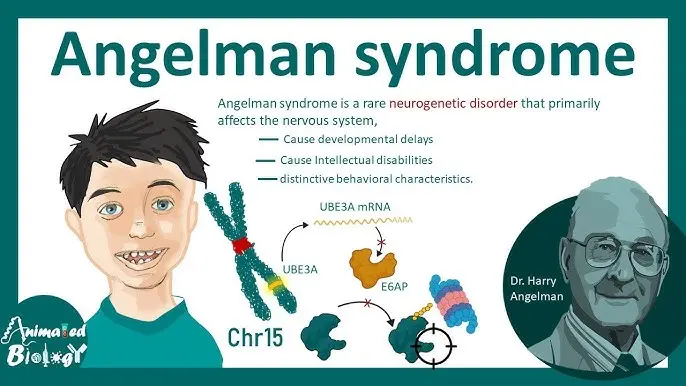 Síndrome de Angelman: Una mirada profunda a esta condición genética - Cómo aprenden los niños con síndrome de Angelman angelman - Cómo aprenden los niños con síndrome de Angelman