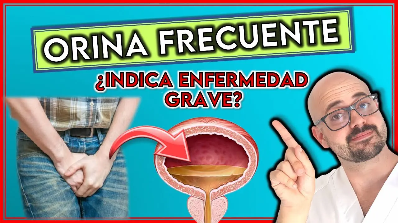 Cómo calmar la sensación de orinar a cada rato: Estrategias para recuperar el control - Cómo calmar la sensación de orinar a cada rato ganas de orinar a cada rato - Cómo calmar la sensación de orinar a cada rato