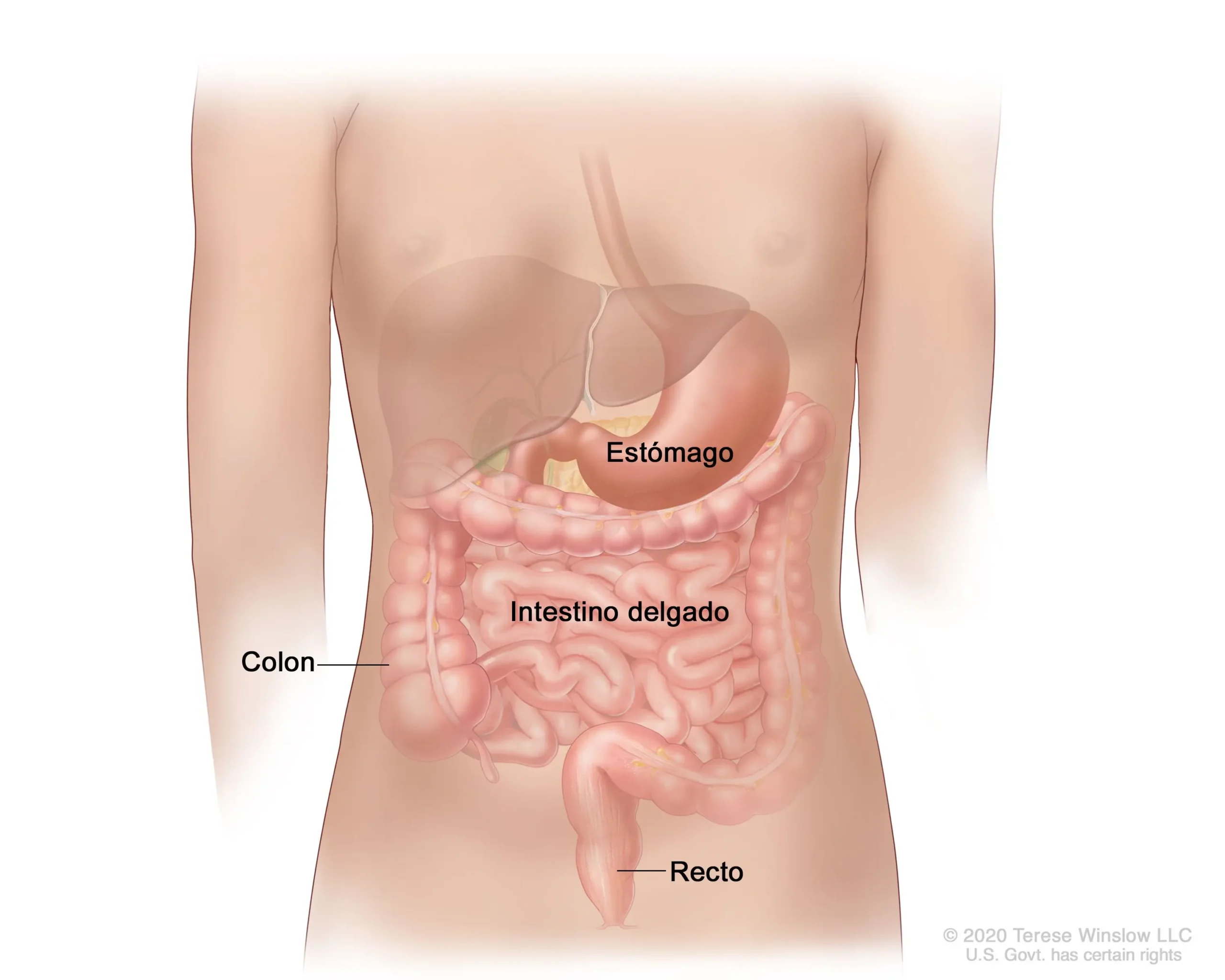Tumor en el Intestino: Diagnóstico, Tratamiento y Todo lo que Necesitas Saber - Cómo comienza el cáncer de intestino tumor en el intestino - Cómo comienza el cáncer de intestino