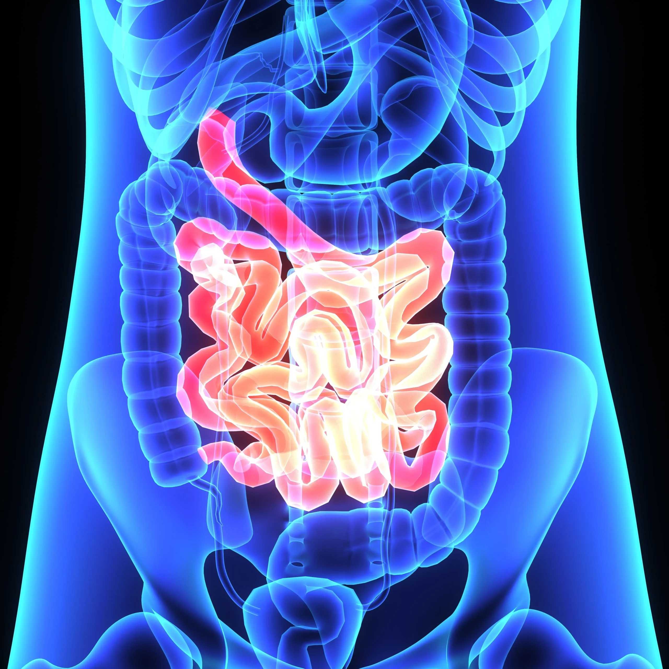 Malabsorción Intestinal: Causas, Síntomas y Tratamiento - Cómo corregir la mala absorción intestinal malabsorción - Cómo corregir la mala absorción intestinal