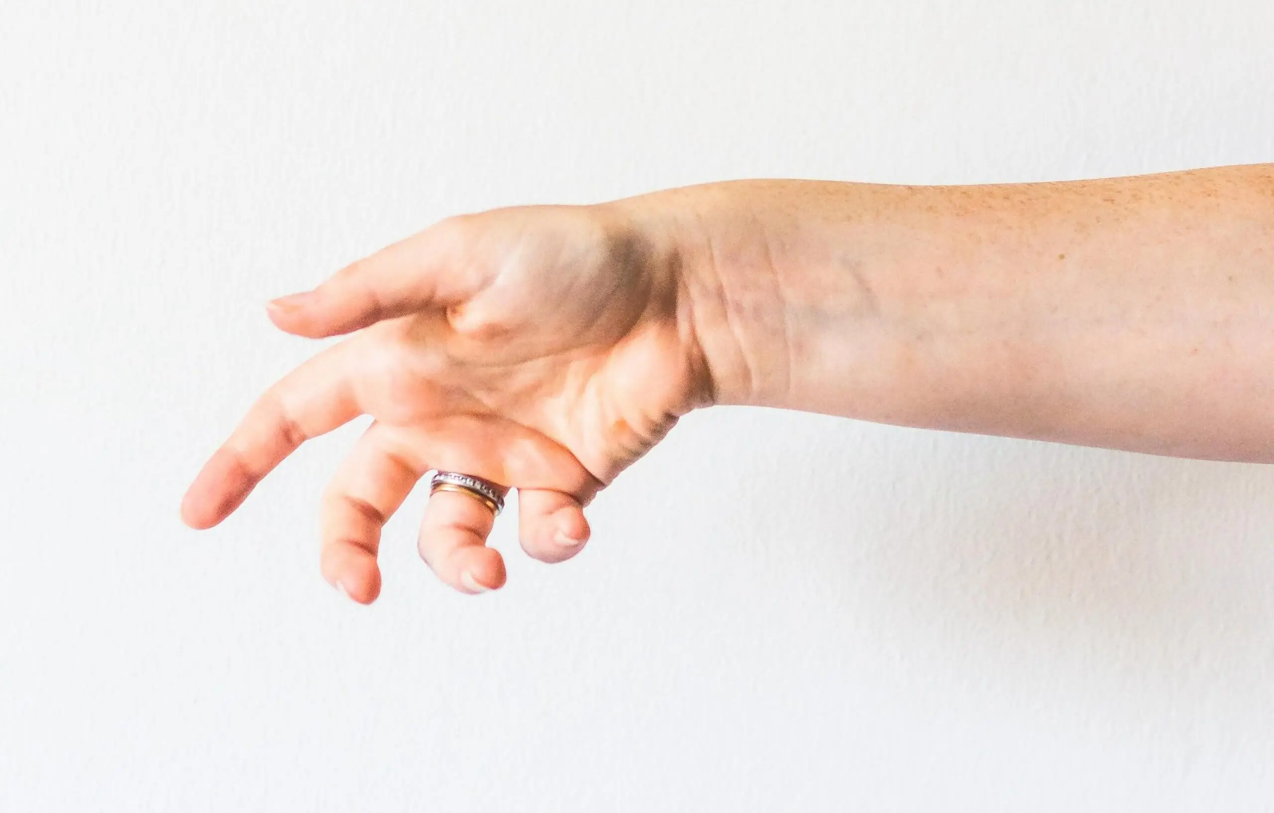 Dedo en Resorte: Causas, Síntomas y Tratamiento - Cómo curar el dedo pulgar en resorte dedo pulgar en resorte - Cómo curar el dedo pulgar en resorte