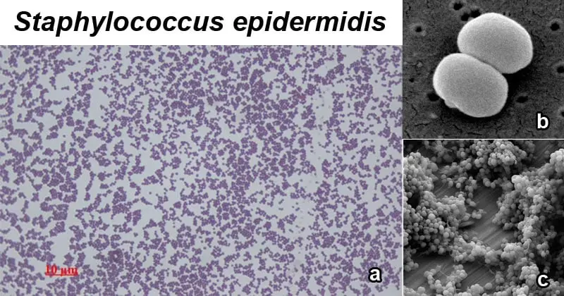 Staphylococcus epidermidis: Una bacteria común con implicaciones clínicas - Cómo diferenciar Staphylococcus epidermidis epidermidis - Cómo diferenciar Staphylococcus epidermidis
