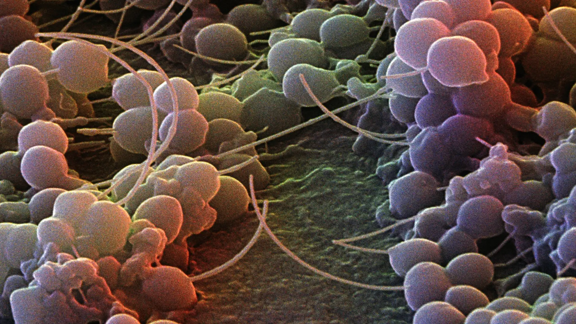 Staphylococcus epidermidis: Una bacteria común con implicaciones clínicas - Cómo eliminar la bacteria Staphylococcus epidermidis epidermidis - Cómo eliminar la bacteria Staphylococcus epidermidis