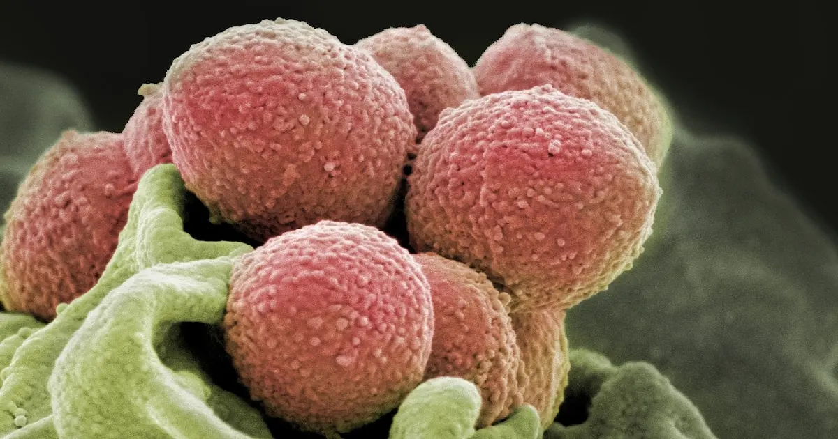 La Bacteria de la Carne Cruda: Riesgos, Síntomas y Prevención - Cómo empieza la bacteria come carne bacteria de la carne cruda - Cómo empieza la bacteria come carne