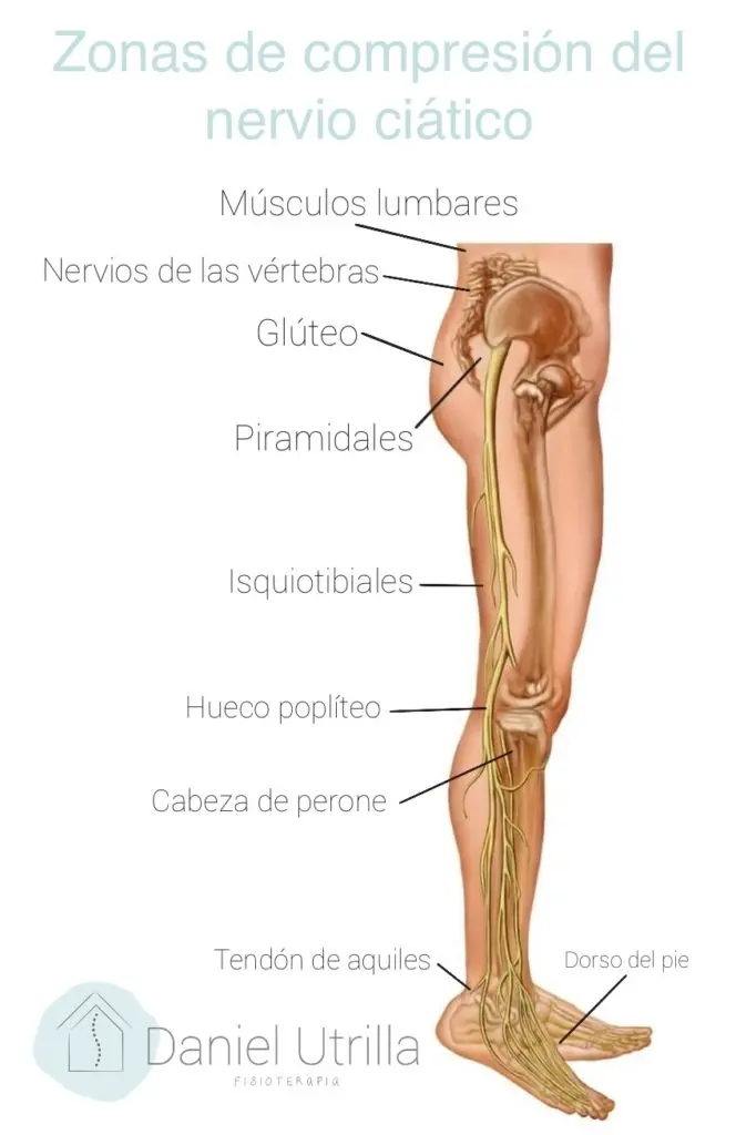 Nervios de la pierna: Anatomía, función y trastornos - Cómo es el dolor de nervios en las piernas nervios de la pierna - Cómo es el dolor de nervios en las piernas