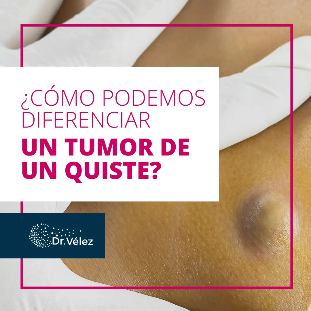 Los tumores duelen: cuándo preocuparse y qué síntomas buscar - Cómo es el tacto de un tumor los tumores duelen - Cómo es el tacto de un tumor
