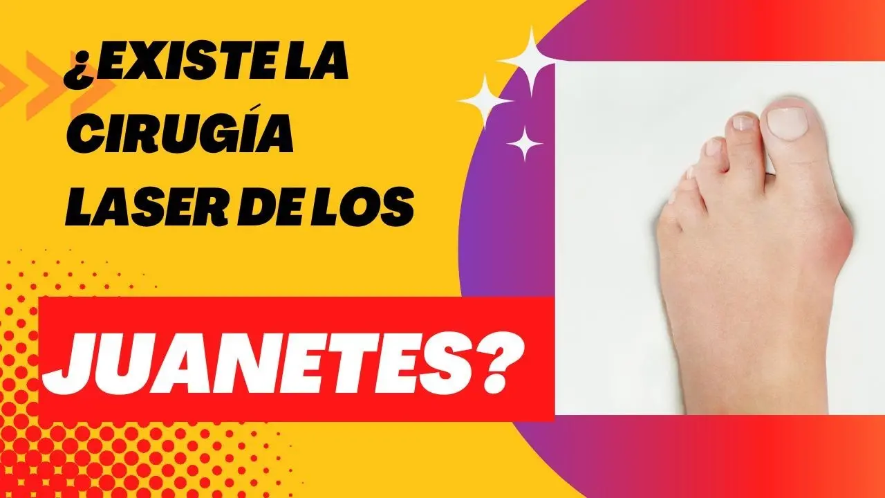 Cirugía de Juanetes con Láser: La Solución Definitiva para el Dolor - Cómo es la cirugía de juanetes con láser cirugia de juanetes con laser - Cómo es la cirugía de juanetes con láser