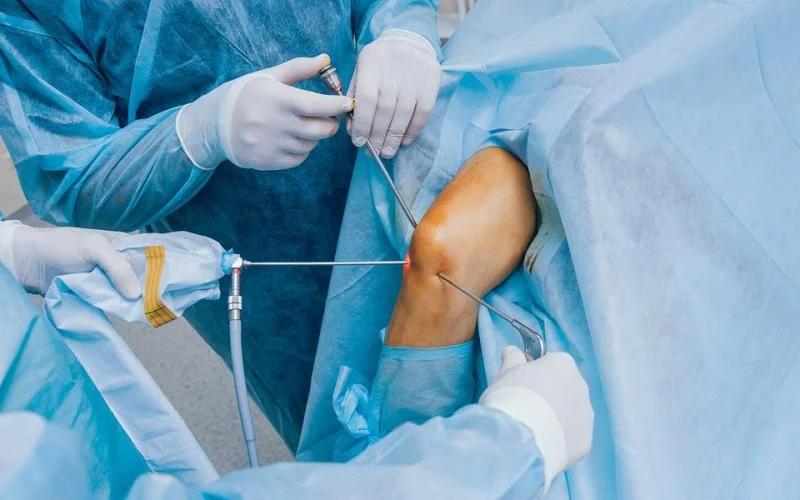 operacion de meniscos - Cómo es la cirugía de meniscos