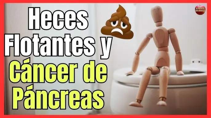 Heces Flotantes y Cáncer: ¿Qué Debes Saber? - Cómo es la materia fecal cuando hay cáncer heces que flotan cancer - Cómo es la materia fecal cuando hay cáncer