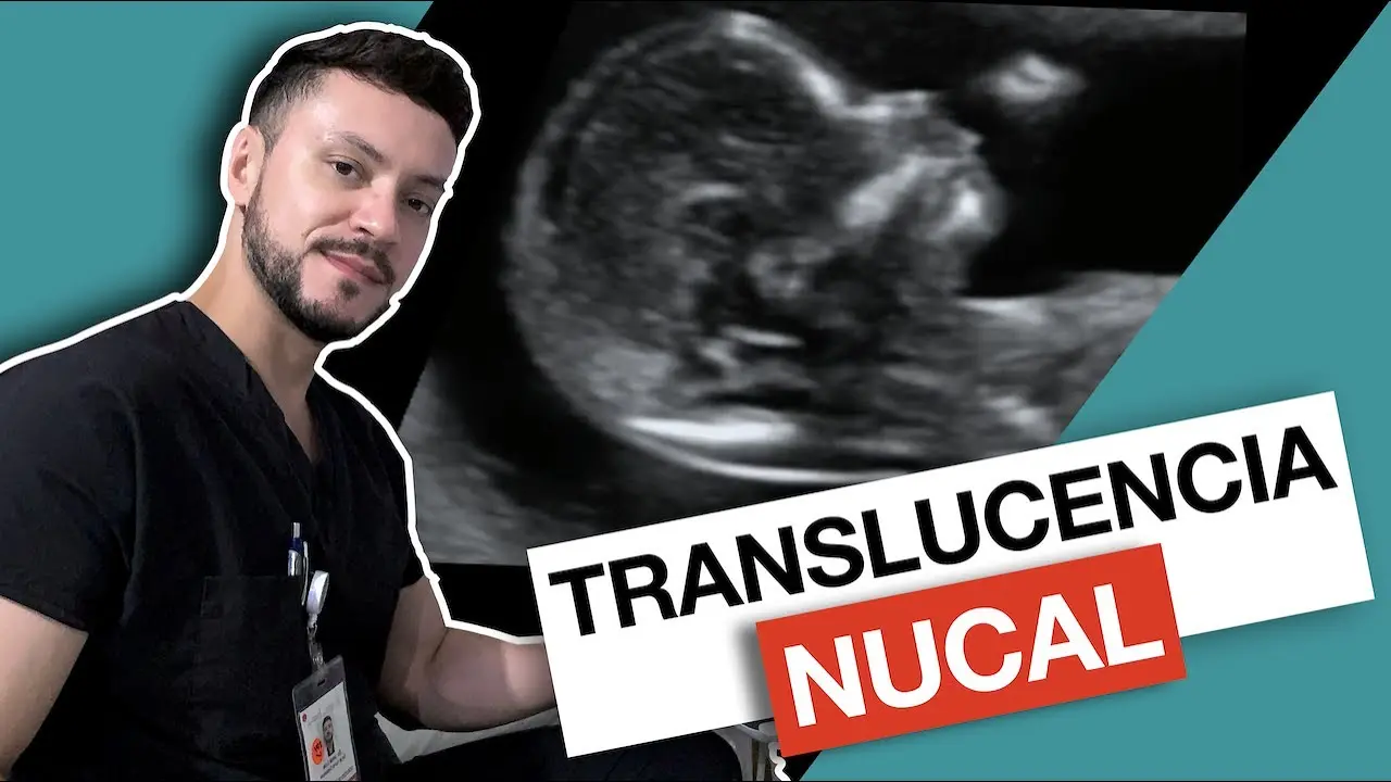 Ecografía Obstétrica con Translucencia Nucal: Guía Completa - Cómo es una ecografía obstétrica con translucencia nucal ecografia obstetrica con translucencia nucal - Cómo es una ecografía obstétrica con translucencia nucal
