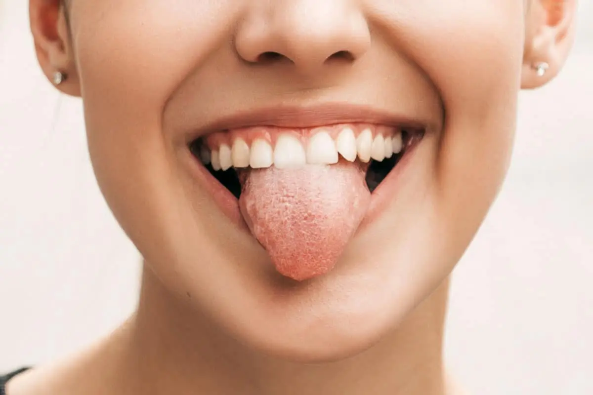 Enfermedades de la lengua: causas, síntomas y tratamiento - Cómo está la lengua normal lengua covid - Cómo está la lengua normal