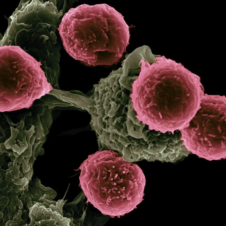 vacuna cancer - Cómo funciona el tratamiento con vacuna contra el cáncer