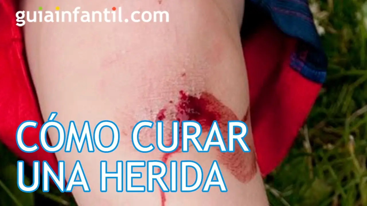 Cómo Curar una Herida Profunda: Guía Completa para una Cicatrización Óptima - Cómo hacer cicatrizar una herida rápidamente como curar una herida profunda - Cómo hacer cicatrizar una herida rápidamente