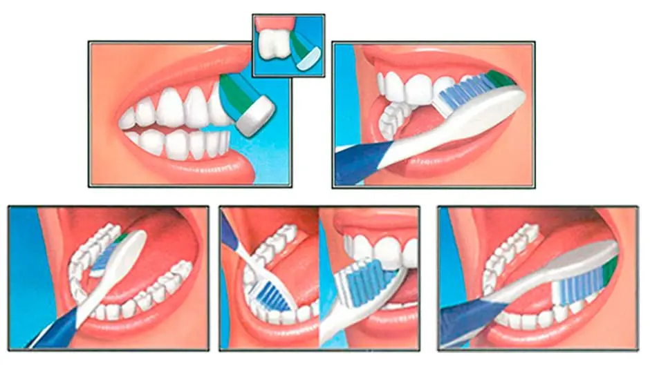 La técnica de cepillado dental para niños: una guía completa - Cómo hacer el cepillado correcto tecnica de cepillado para niños - Cómo hacer el cepillado correcto