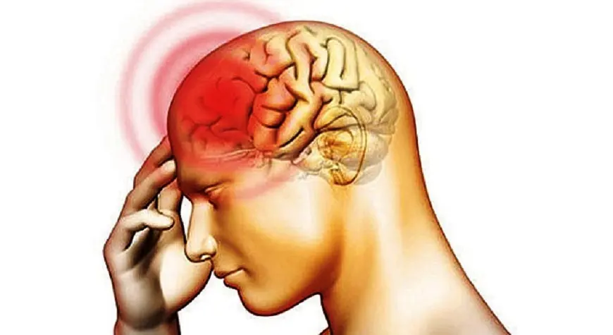 Meningitis Aséptica: Causas, Síntomas, Diagnóstico y Tratamiento - Cómo prevenir la meningitis aséptica meningitis aseptica - Cómo prevenir la meningitis aséptica