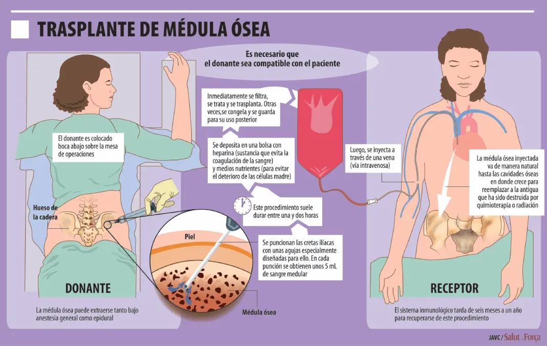 Leucemia: ¿Es contagiosa? Todo lo que necesitas saber - Cómo puedo contraer la leucemia la leucemia es contagiosa - Cómo puedo contraer la leucemia