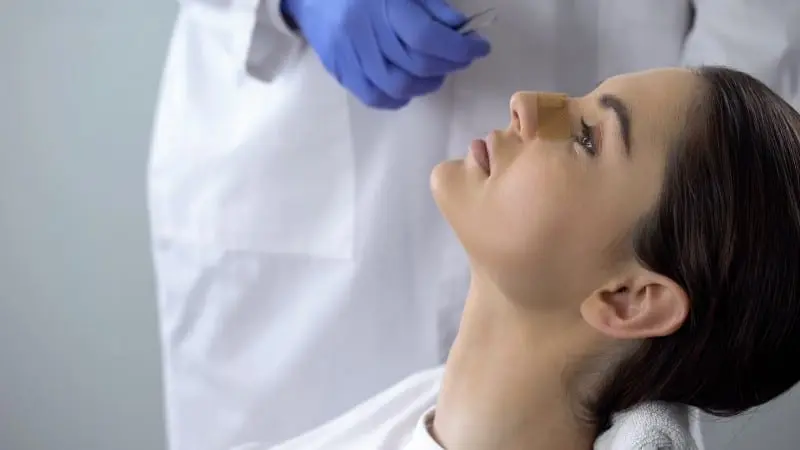 Operación de Tabique Desviado: Todo lo que Necesitas Saber - Cómo queda la nariz después de una operación de tabique operacion de tabique desviado - Cómo queda la nariz después de una operación de tabique