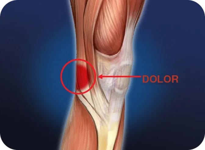 Dolor detrás de la rodilla: Causas, Remedios y cuándo consultar al médico - Cómo relajar la parte de atrás de la rodilla remedios para el dolor detras de la rodilla - Cómo relajar la parte de atrás de la rodilla