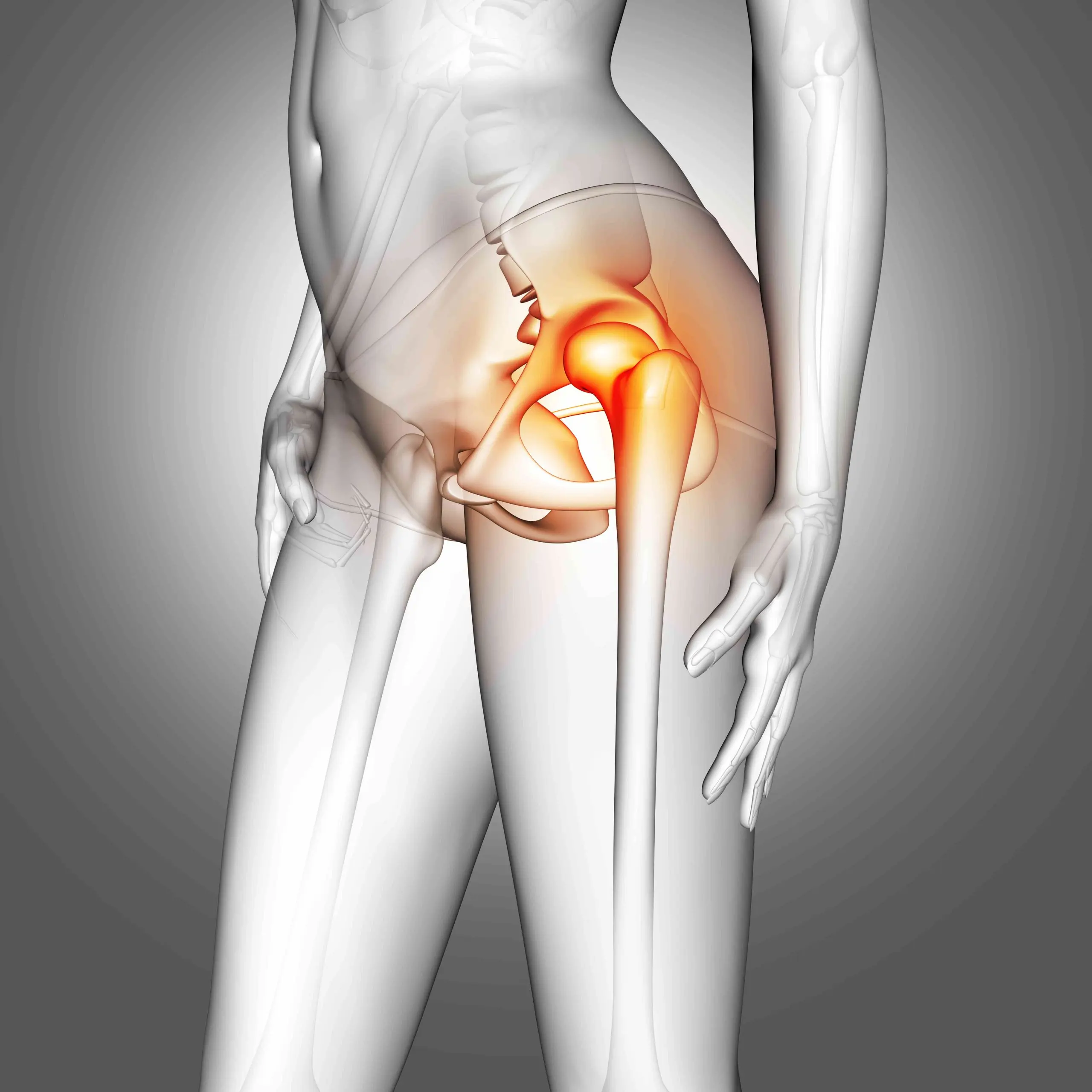 Dolor de Cadera en Mujeres: Causas, Síntomas y Tratamiento - Cómo saber si el dolor de cadera dolor de cadera en mujeres - Cómo saber si el dolor de cadera