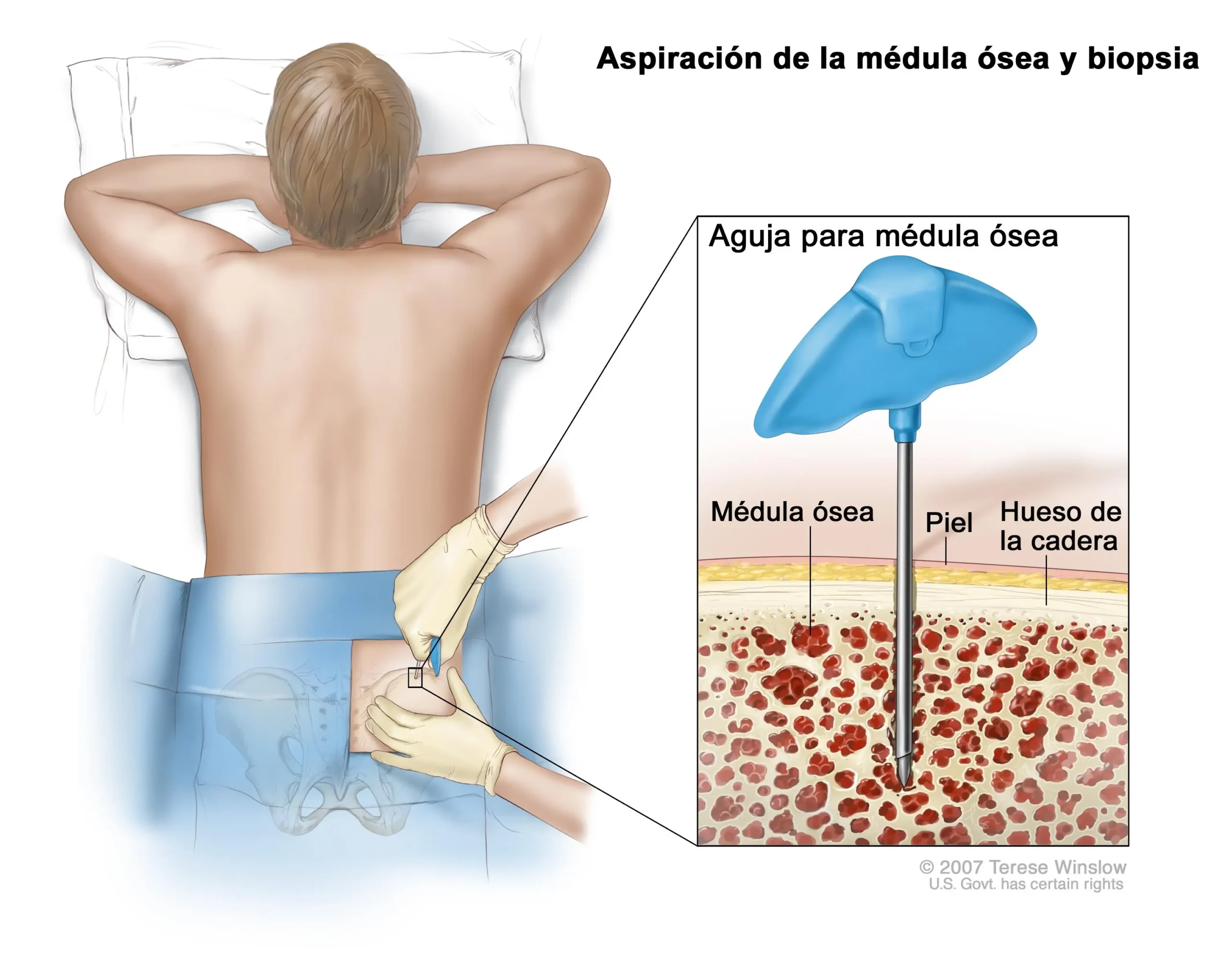 Cómo saber si eres compatible con la médula ósea: Guía para donantes emparentados - Cómo saber si eres compatible con la médula como se si soy donante de medula osea - Cómo saber si eres compatible con la médula