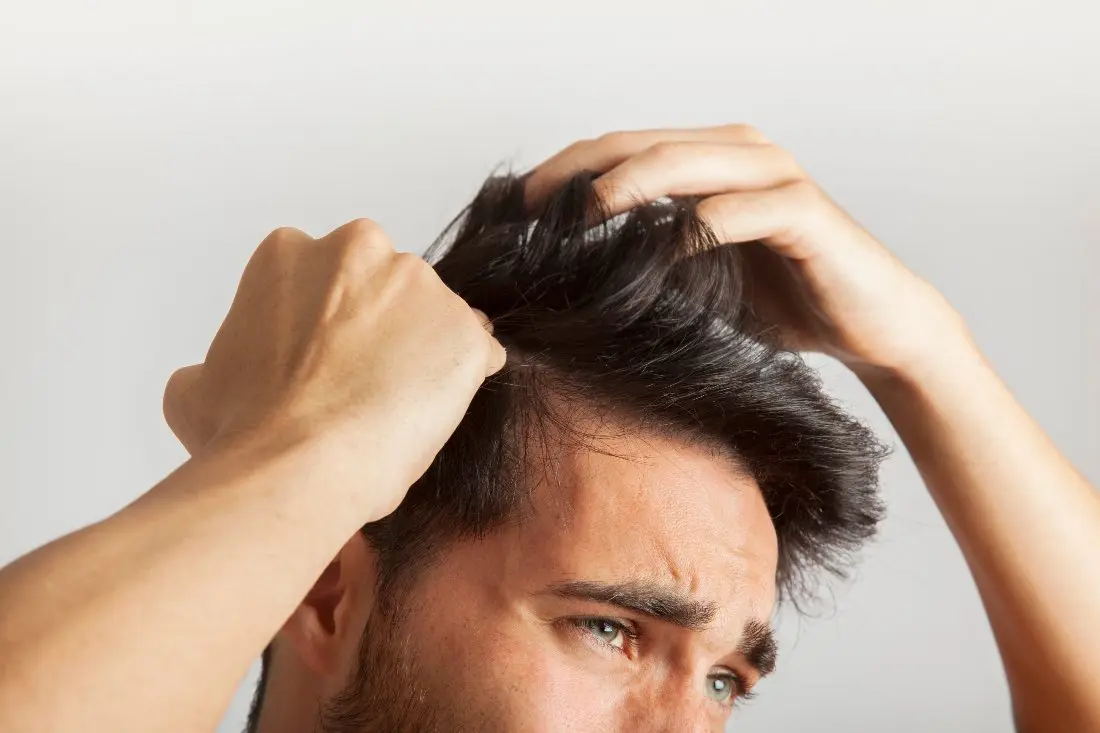 Caída del cabello en hombres: Cómo identificar la causa del estrés - Cómo saber si la caída del cabello es por estrés caida de cabello hombres - Cómo saber si la caída del cabello es por estrés