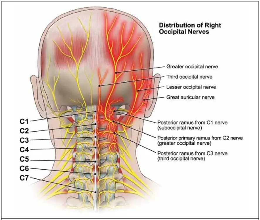 Neuralgia Occipital: Causas, Síntomas y Tratamiento - Cómo saber si tengo neuralgia occipital neuralgia occipital sintomas - Cómo saber si tengo neuralgia occipital
