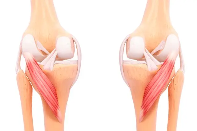 Tendonitis Rotuliana: Causas, Síntomas y Tratamiento del Dolor Detrás de la Rodilla - Cómo saber si tengo un tendón inflamado en la rodilla tendon detras de la rodilla - Cómo saber si tengo un tendón inflamado en la rodilla