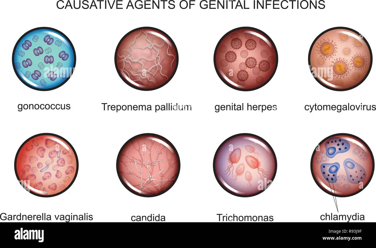 Gardnerella En Hombres: ¿Qué Es Y Cómo Detectarla? | Doctor Online
