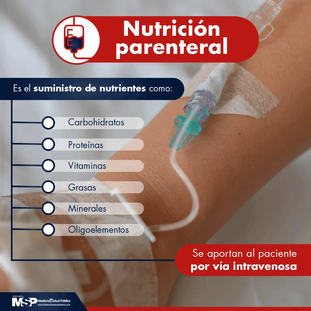 Nutrición Parenteral: Guía Completa para Pacientes - Cómo se calcula la nutrición parenteral nutricion parenteral - Cómo se calcula la nutrición parenteral