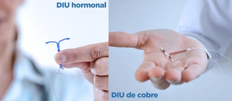 SIU Minera: El dispositivo intrauterino para la planificación familiar - Cómo se consigue el SIU siu minera - Cómo se consigue el SIU