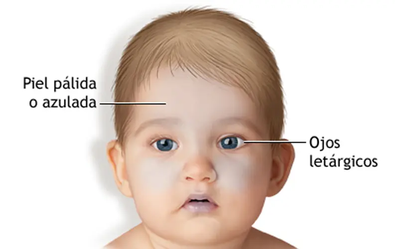 Ronquido en el pecho: causas, síntomas y cuándo consultar al médico - Cómo se cura el ronquido en el pecho ronquido en el pecho - Cómo se cura el ronquido en el pecho