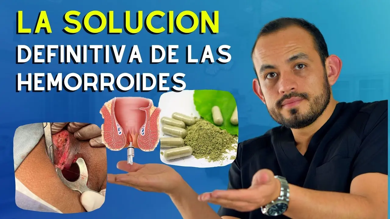 Cómo Se Desaparecen las Hemorroides Internas - Cómo se desaparecen las hemorroides internas como curar las hemorroides internas - Cómo se desaparecen las hemorroides internas