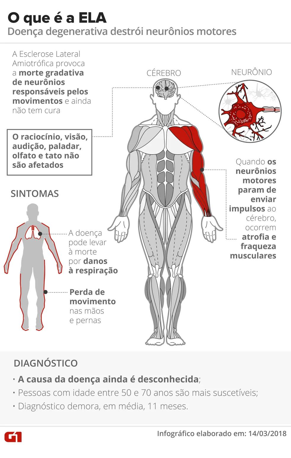 Cómo se Diagnostica la ELA: Una Guía Completa - Cómo se diagnostica un ELA ela diagnostico - Cómo se diagnostica un ELA