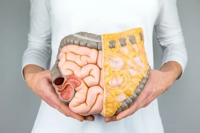 Adherencias Abdominales: Causas, Formación y Prevención - Cómo se forman las adherencias después de una cirugía adherencias abdominales - Cómo se forman las adherencias después de una cirugía