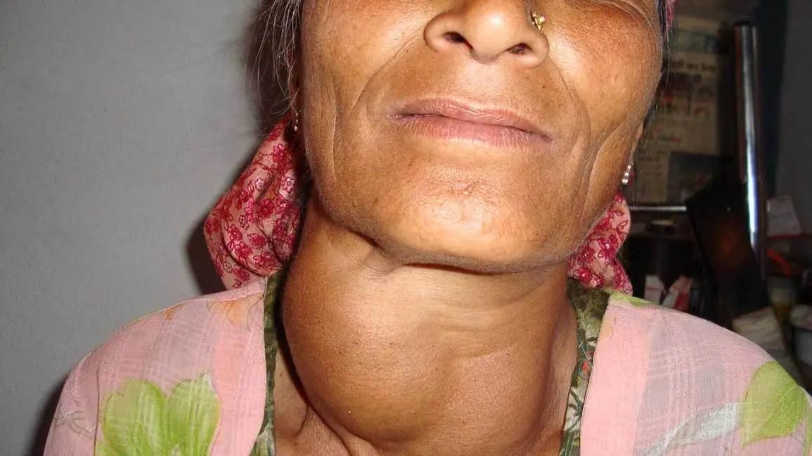 Anatomía del cuello: una guía completa - Cómo se llama lo que tenemos dentro del cuello partes del cuello y garganta - Cómo se llama lo que tenemos dentro del cuello
