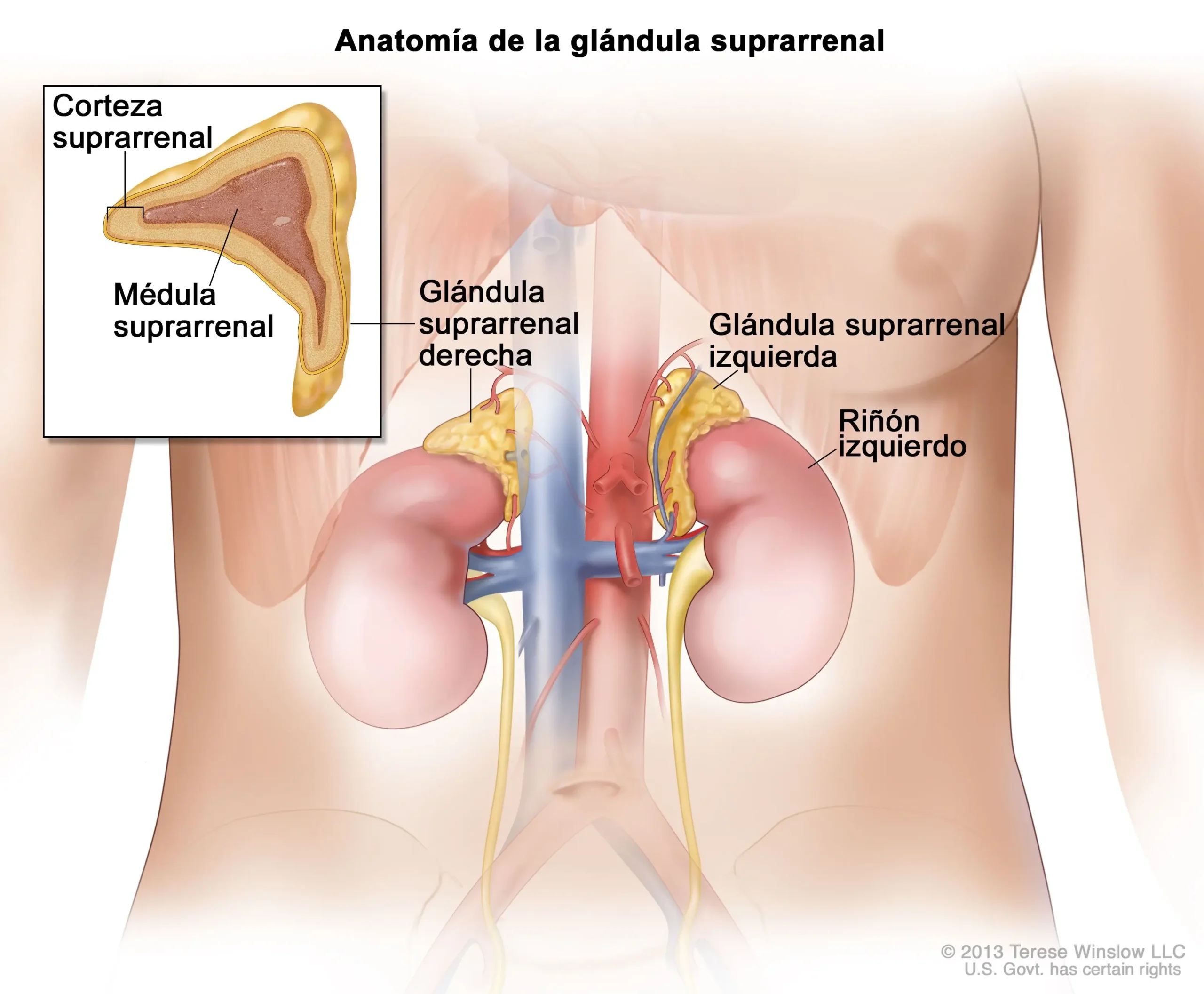 Tumores Suprarrenales: Intervención y Tratamiento Quirúrgico - Cómo se opera un tumor suprarrenal tumor suprarrenal - Cómo se opera un tumor suprarrenal