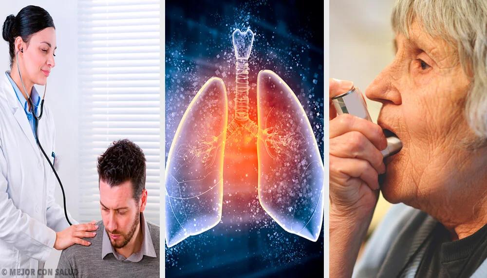 Enfisema Pulmonar: Diagnóstico, Tratamiento Y Cómo Vivir Con él ...