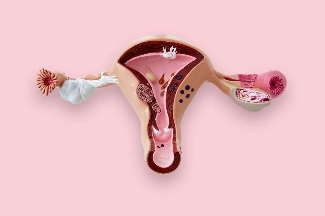 Biopsia de Cuello Uterino: Qué Esperar, Riesgos y Resultados - Cómo se realiza una biopsia en el cuello del útero biopsia de cuello uterino - Cómo se realiza una biopsia en el cuello del útero