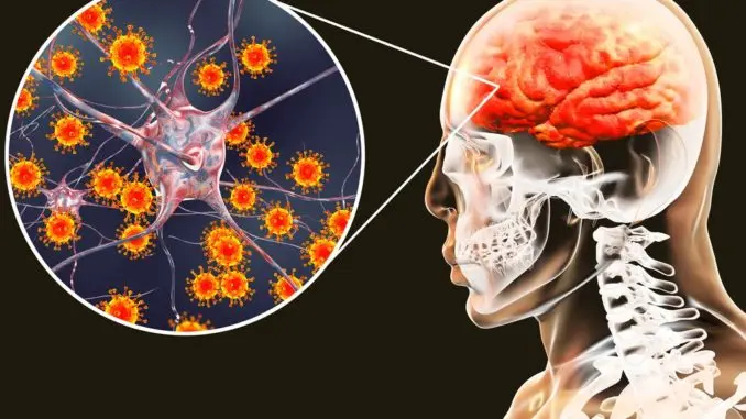 Meningitis Aguda: Una Guía Completa sobre Causas, Síntomas, Tratamiento y Prevención - Cómo se transmite el virus de la meningitis meningitis aguda - Cómo se transmite el virus de la meningitis