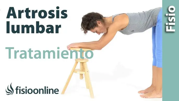Espondilosis Lumbar: Tratamiento y alivio del dolor - Cómo se trata la espondilosis lumbar espondilosis lumbar tratamiento - Cómo se trata la espondilosis lumbar