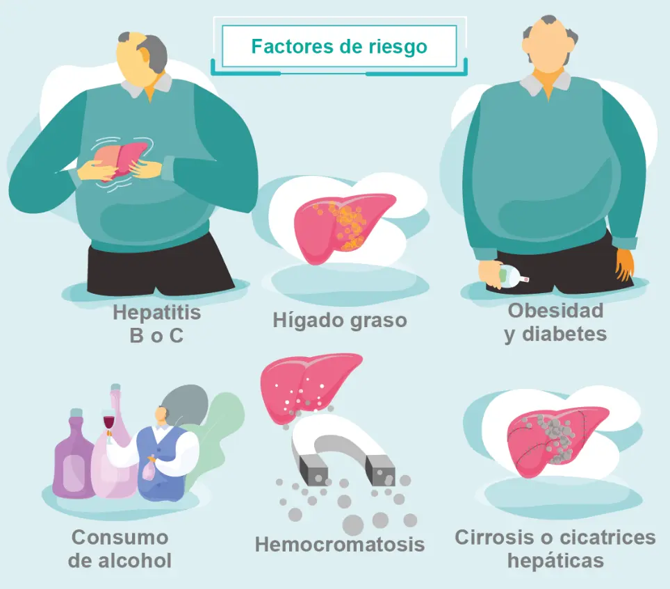 Cáncer de Hígado: Tratamiento, Etapas y Quimioterapia - Cómo son las quimioterapias de cáncer de hígado cancer de higado tratamiento - Cómo son las quimioterapias de cáncer de hígado