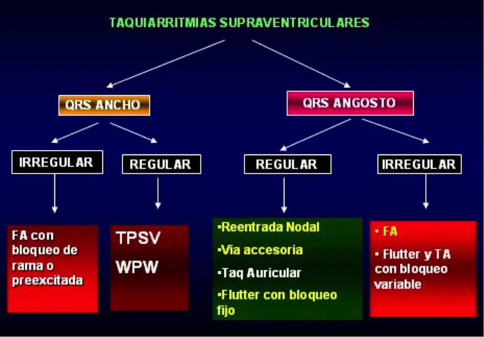 Clasificación de las Arritmias: Una Guía Completa - Cuál es la arritmia más común clasificacion de arritmias - Cuál es la arritmia más común