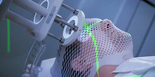 Radiocirugía: Una guía completa sobre este procedimiento - Cuál es la diferencia entre radioterapia y radiocirugía radiocirugia - Cuál es la diferencia entre radioterapia y radiocirugía