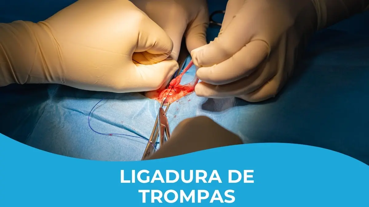 Vasectomía: La edad adecuada para tomar la decisión - Cuál es la edad adecuada para operarse para no tener hijos operacion para no quedar embarazada - Cuál es la edad adecuada para operarse para no tener hijos