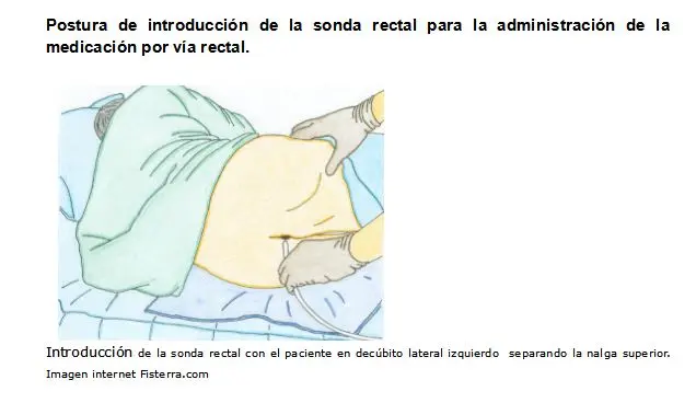 La posición correcta para colocar un enema: Guía completa - Cuál es la posición correcta para poner un enema posicion para colocar enema - Cuál es la posición correcta para poner un enema