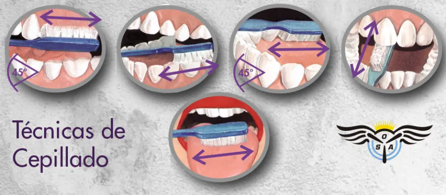 La técnica de cepillado dental para niños: una guía completa - Cuál es la técnica de fones tecnica de cepillado para niños - Cuál es la técnica de fones