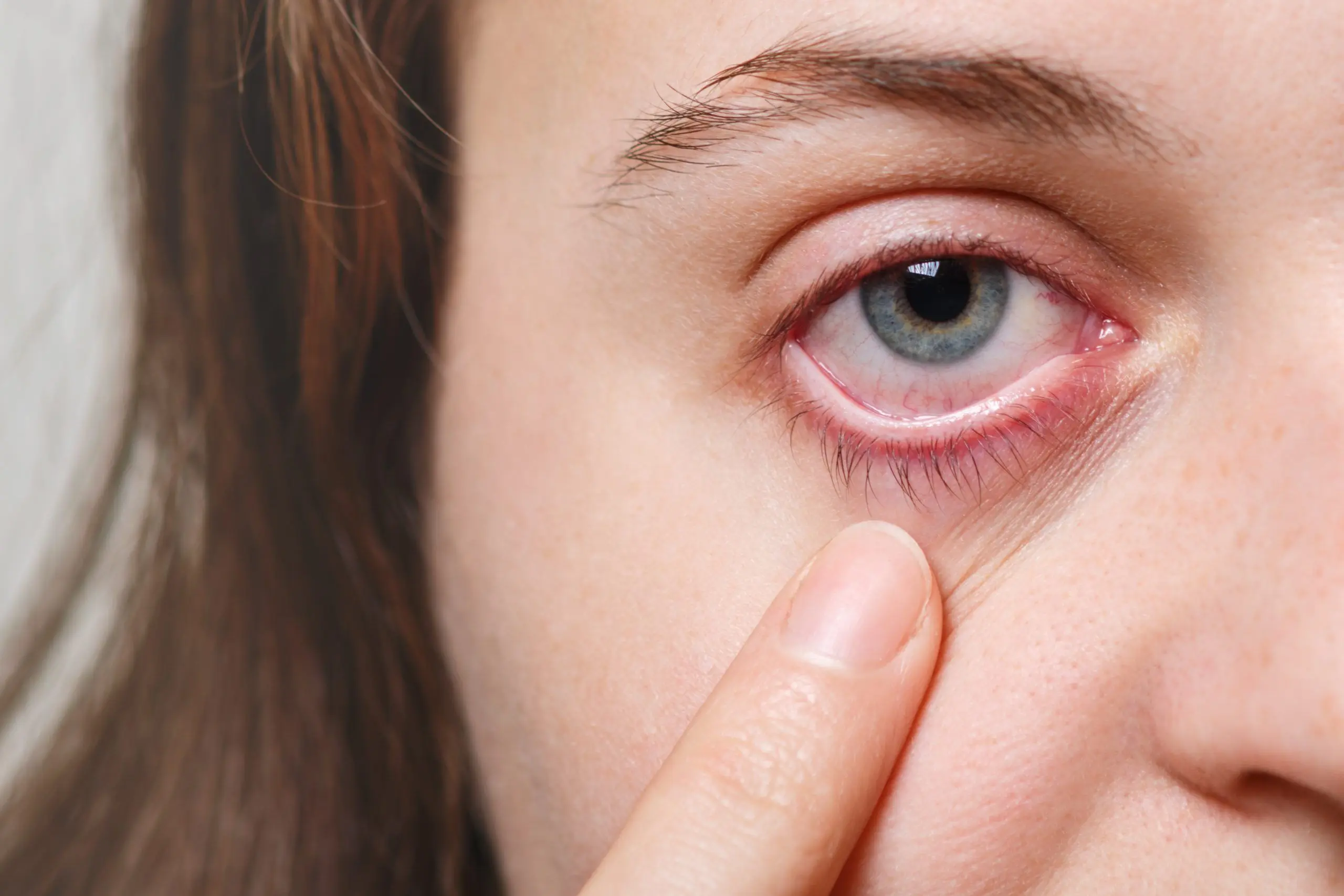 Enfermedades Oculares: Una Guía Completa para la Salud de tus Ojos - Cuáles son las enfermedades más comunes en los ojos enfermedades de los ojos - Cuáles son las enfermedades más comunes en los ojos