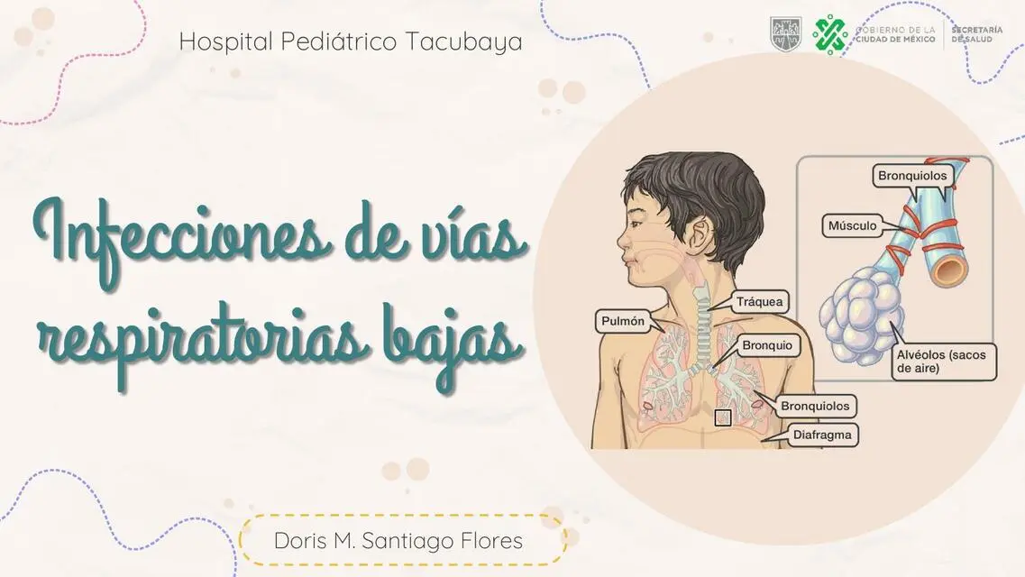 Infecciones Respiratorias Bajas: Causas, Síntomas y Prevención - Cuáles son las infecciones respiratorias altas y bajas infecciones respiratorias bajas - Cuáles son las infecciones respiratorias altas y bajas