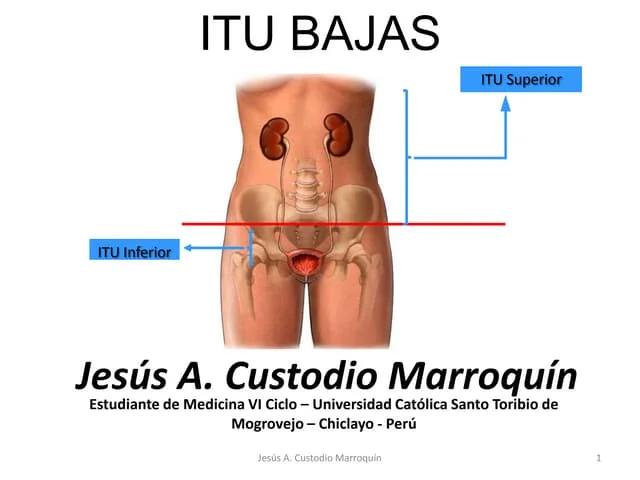 Infecciones Urinarias: Todo lo que necesitas saber sobre las infecciones altas y bajas - Cuáles son las infecciones urinarias bajas infecciones urinarias altas y bajas - Cuáles son las infecciones urinarias bajas