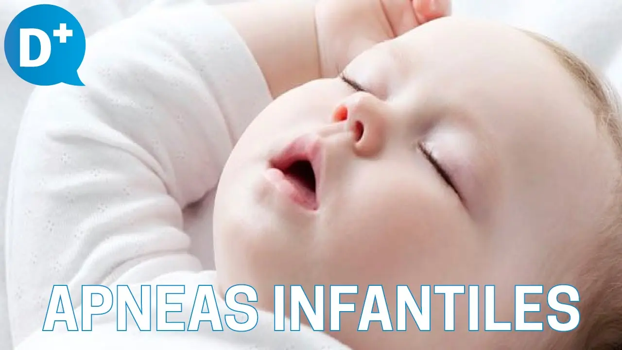 Apnea del sueño en bebés: causas, síntomas y tratamiento - Cuándo desaparece la apnea en bebés apnea del sueño en bebes - Cuándo desaparece la apnea en bebés